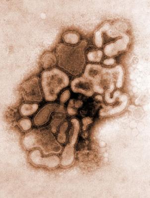 http://mplbelgique.files.wordpress.com/2009/10/grippe-porcine-virus-h1n1.jpg